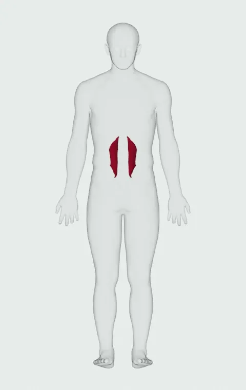 Quadratus Lumborum highlighted on an anatomical figure, from behind.