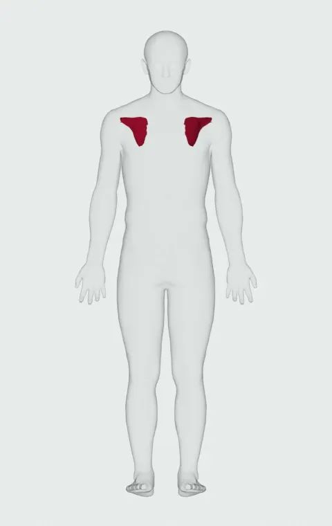 Subscapularis highlighted on an anatomical figure, from behind.